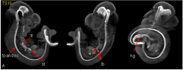 3D imaging of Hnf3b expression